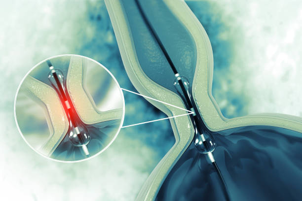 best interventional radiologist in mumbai