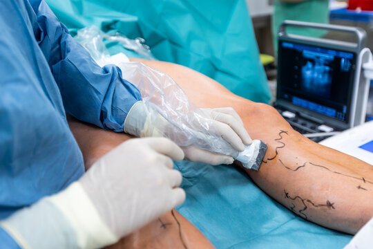 vascular surgeon in mumbai